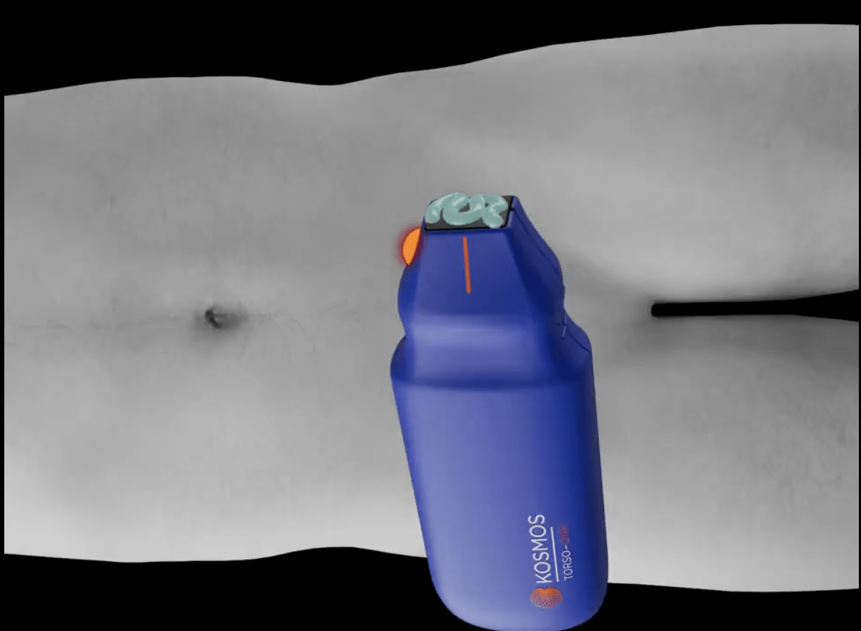 Applying gel to Kosmos Torso-One Probe